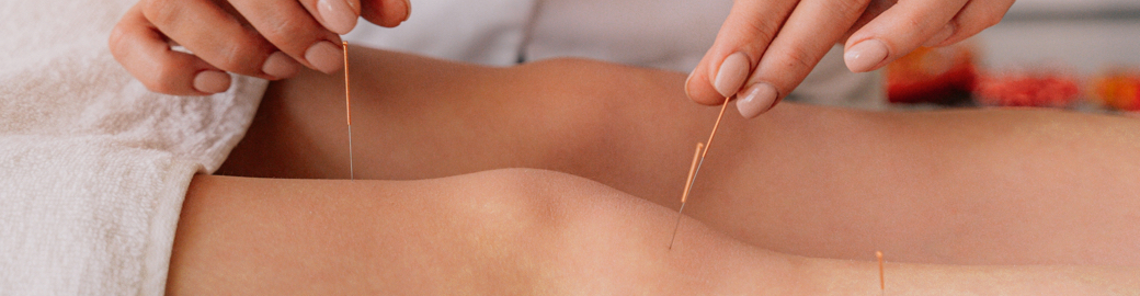 Qu'est-ce que l'acupuncture?